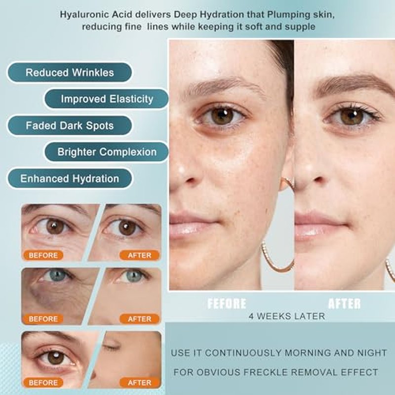 Vitamin C Serum for face with Hyaluronic Acid & Peptides - Anti Aging Face Serum for Women & Men, Dark Spot Corrector for Brightening, Hydrating Treatment to Reduce Wrinkles & Fine Lines, (Pack of 2)