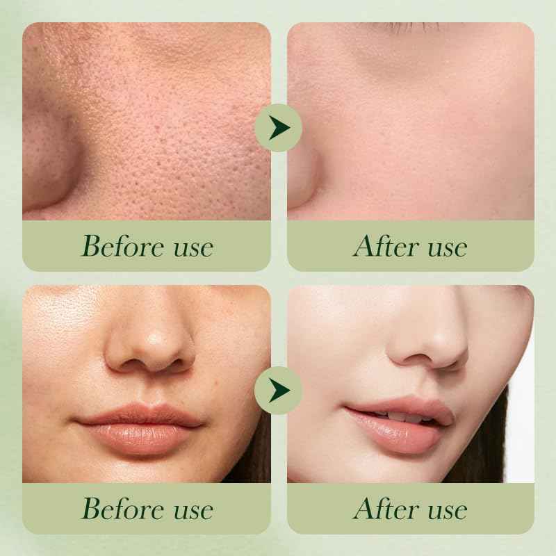 Avocado Skincare Sets, 6Pcs Skincare Gift Set with Facial Cleanser, Face Serum, Face Cream, Eye Cream, Toner, moisturizing Lotion, Skin Care Sets & Kits, Hydrating Facial Kit for women