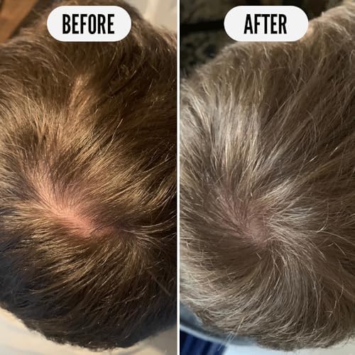 Noughty 97% Natural Get Set Grow Tonic, Leave in Treatment for Thicker and Fuller Looking Hair, 97% Natural, with Pea Complex and Hyaluronic Acid 75ml