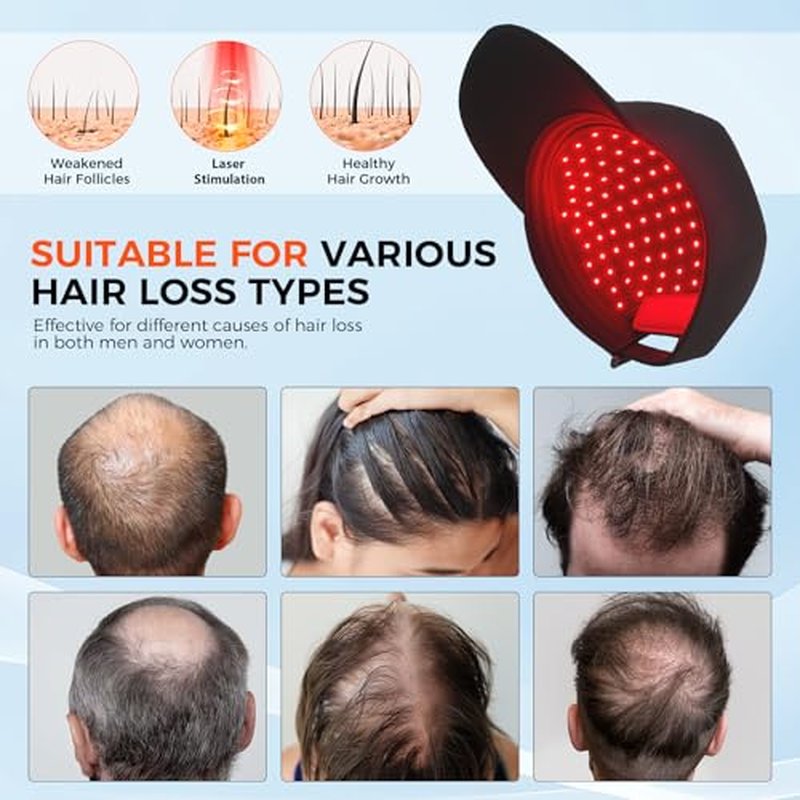 Red Light Hair Growth Cap - Laser Hair Growth Cap, The Adjustable Portable Laser Cap, Promote Hairs