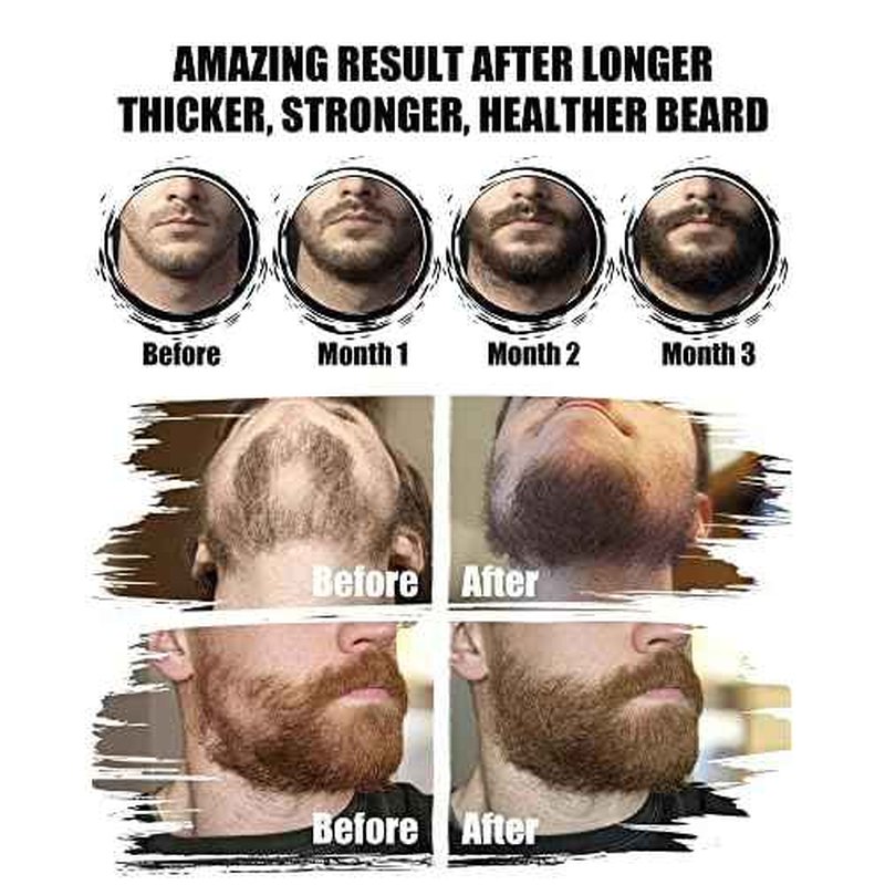 Beard Kit for Men Grooming & Care: with 2 Pack Beard Oils and Balm - Wash & Conditioner for After Shave Lotions Sandalwood, Brush and Comb Sets with Scissors, Valentines Fathers Gifts for Dad/Men/Him