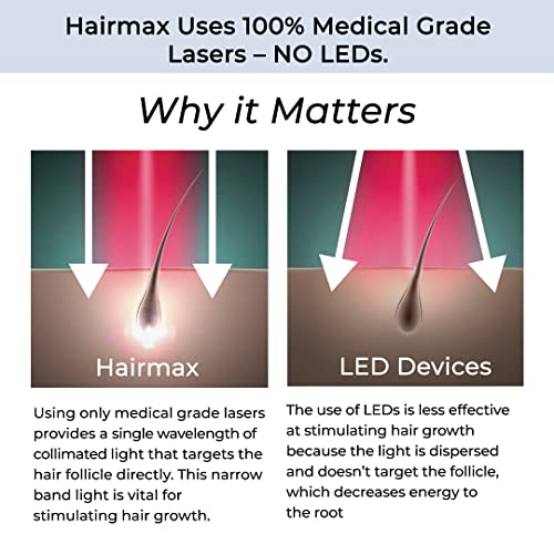 HairMax Laser Band 41 - (FDA Cleared) Hair Growth Device - Restores Natural Hair Cycle with Red Light Therapy