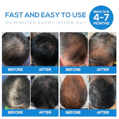 Laser Hair Growth Cap£¬Laser Hair Growth Cap is Low Level Laser Therapy (LLLT) Devices That Promote Hair Growth in Women and Men