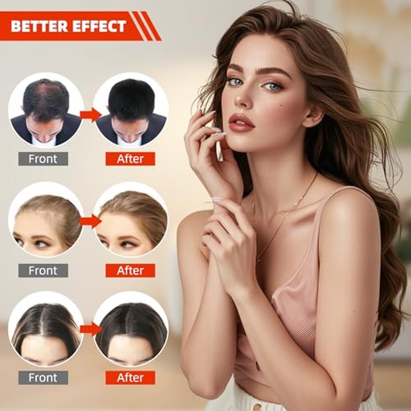 Irradiation Laser Hair Growth Cap£¬Red Light theray for Hair,Red Light Hair Growth Cap