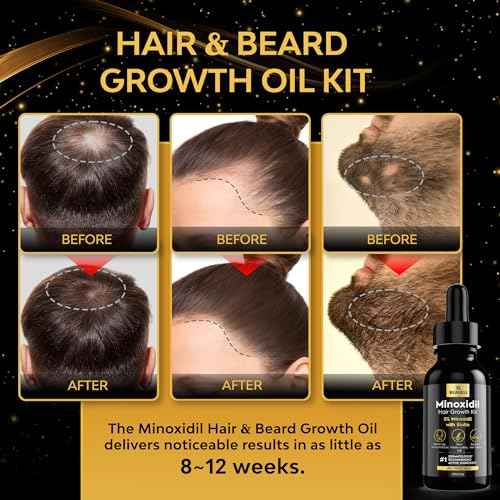 Minoxidil for Men, Minoxidil for Men Beard Growth Kit, Minoxidil for Women Hair Growth Kit, Hair Regrowth for Men, Beard Growth Serum, Minoxidil 5 Percent (Black)