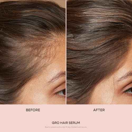 VEGAMOUR GRO Hair Serum for Hair Thinning & Shedding, Thicker Fuller Looking Hair In As Soon As 90 Days, Non Oily, Bergamot Scent, Vegan & Cruelty Free