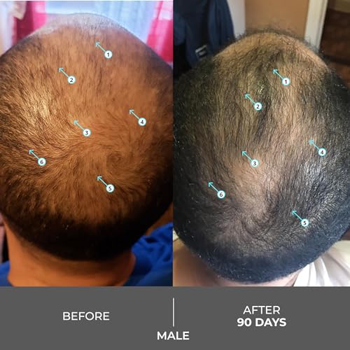 DS Labs Revita Extra Strength Shampoo, 205mL ? Scalp First Cleanse for Fuller, Thicker Looking Hair, Lightweight Hydration, Sulfate Free, Color Safe, For Men & Women