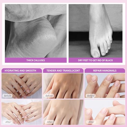 Hydrating Hand Foot Masks Set,3 Pack Glove Mask for Dry Hand,Exofliating 3 Pack Socks Maskfor Peeling Away Dead Skin Calluses£¨Lavender£©
