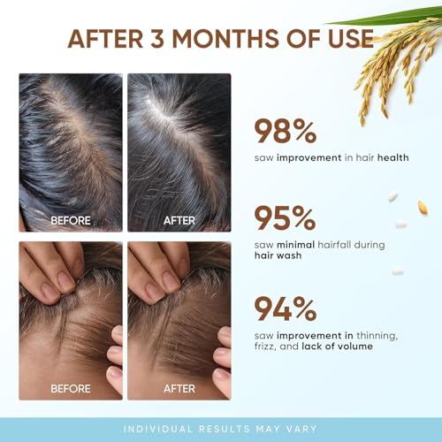 Svvimer Rice Water Hair Growth Shampoo - Biotin Thickening Shampoo for Hair Loss and Thinning - Sulfate Free for Women and Men 10 Fl Oz (Pack of 1)