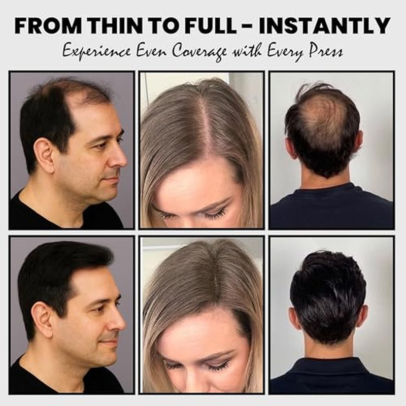 Hair Fibers for Thinning Hair, Hair Building Fibers Spray with Spray Applicator, Undetectable & Long-lasting, Instant Hair Coverage for Men & Women (Black, 30g)