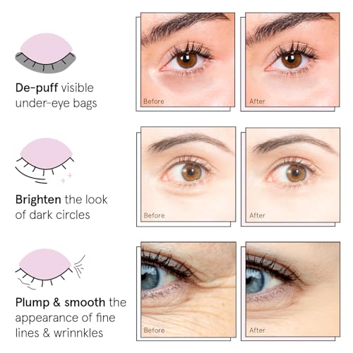 grace & stella Under Eye Patches (12 pairs) Eye Masks for Dark Circles and Puffiness - Stocking Stuffers for Women, Christmas Gifts, Birthday Gifts, Bachelorette Party Favors, Bridesmaid Proposal Gift