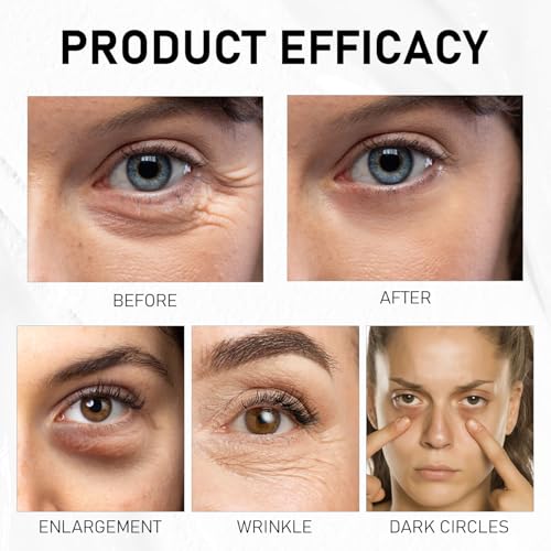 Under Eye Balm Stick for Under Eyes Bags,2025 New Turmeric Cream Erases Eyes Bags Within Minutes,Erase for Dark Circles Puffiness,Moisturizing Under Eye Balm for Travel Care Serum for Women(2PCS)