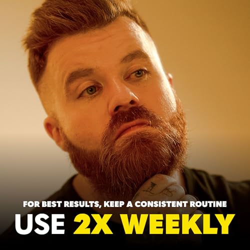 The Beard Club Derma Roller for Face, Body and Scalp - Microneedling for Men and Women with 540 Titanium Microneedles - Beard Roller & Micro Needling Scalp Hair - Black