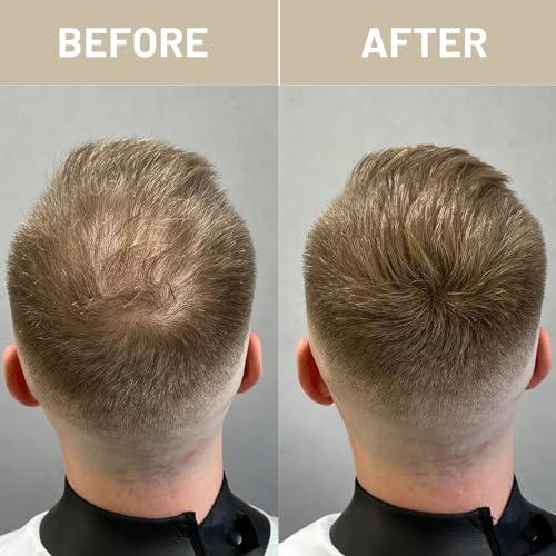 VOLLUCK Hair Fibers for Thinning Hair, Instant Coverage Hair Building Fibers for Women and men, Natural Hair Powder for Conceal Hair Loss 28 g (Black)