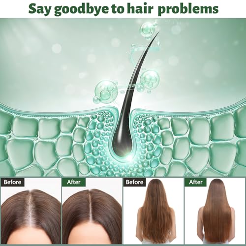 Biotin & Rosemary Hair Growth Shampoo?Natural Formula for Thinning Hair & Hair Loss, Promotes Thicker, Fuller Hair,Hair Growth Shampoo for Men and Women - 10.15 fl OZ