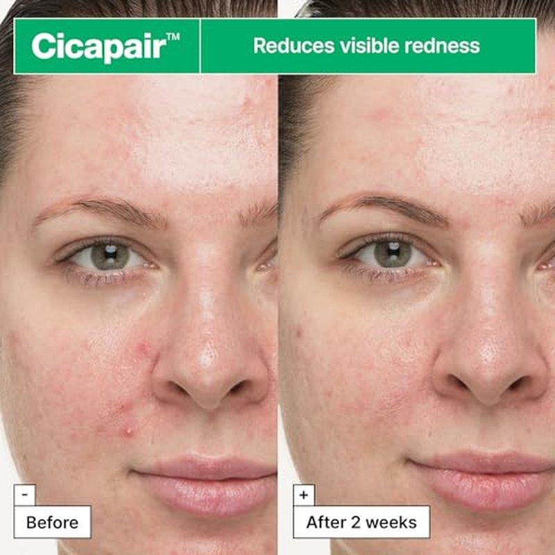 Dr.Jart+ Cicapair So Soothing Face Treatment Korean Gel Cream for Visibly Irritated Skin with Centella Asiatica | Korean Skin Care, 1.01 Fl Oz