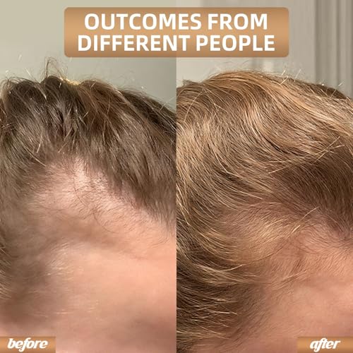 Red Light Therapy for Hair Growth, Laser Cap Hair Regrowth For Women and Men