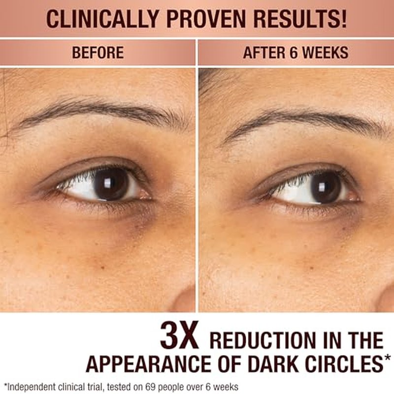Charlotte Tilbury Radiance Recovery Dark Spot Serum - Dark Spot Corrector & Vitamin C Serum for a Brighter-Looking Complexion - Helps Reduce the Appearance of Redness & Uneven Skin Tone