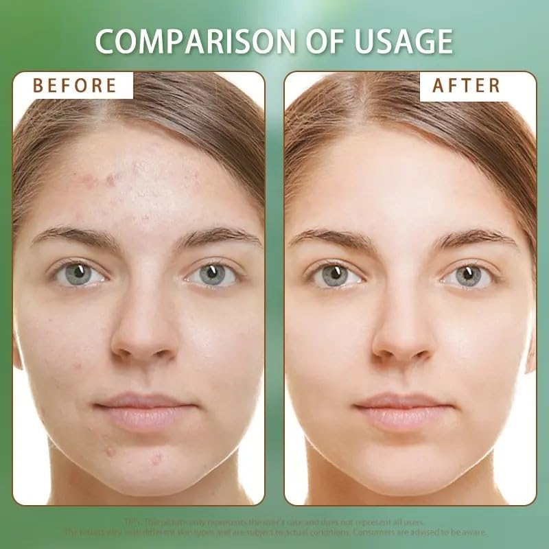 V-Line Beauty Microcrystal Gentle Cleansing Facial Gel Scrub for Oily Skin, 2% BHA + Glycerin + Green Tea + Bamboo, Soothing, Hydrating and Help Clear, Suitable for Sensitive Skin