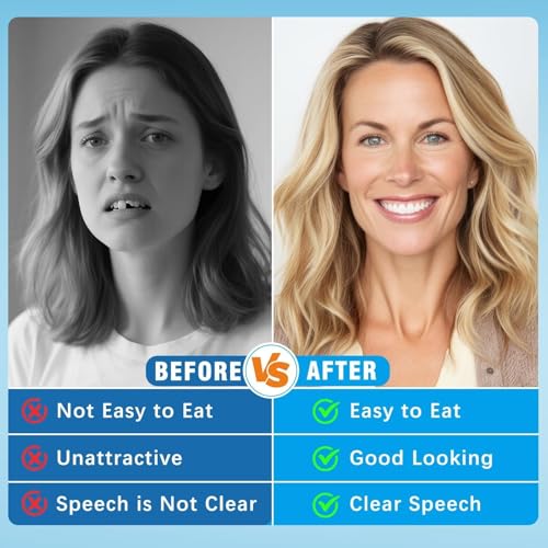 Moldable False Teeth - Silicone Dentures - Men and Veneers Teeth for Women - Upper and Lower Matching Set - Fix Your Smile at Within Minutes - 1PCS - Z