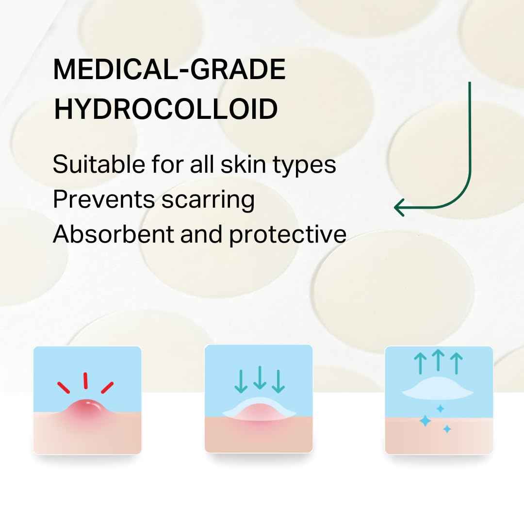 Y’OUR Improving Acne Patches: Ultra-thin Hydrocolloid Pimple Patch for Face; Purifies & Alleviates Stubborn Blemishes, Promotes Healing, Effective Zit Treatment. Made in USA. 56 Count
