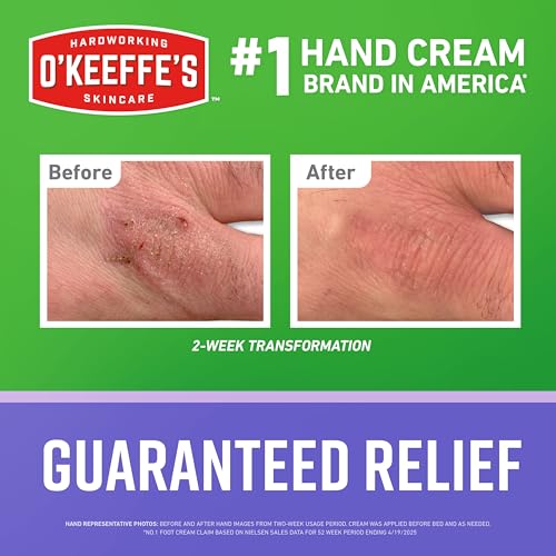 O'Keeffe's Working Hands Night Treatment Hand Cream for Extreme Dryness - 7 oz Tube (1 Pack) - Repairing Skincare for Cracked, Dry Hands