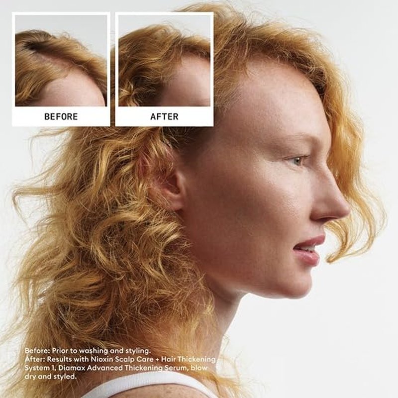 Nioxin Scalp & Hair Thickening System Kit - Boost Density for Natural, Colored & Damaged Hair | 3-Month Supply with Niacinamide & Biotin