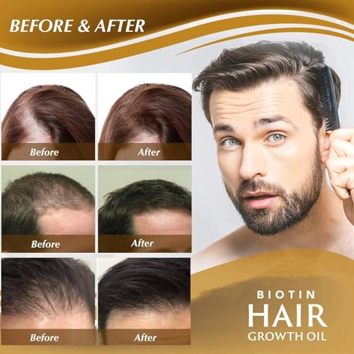 Biotin Hair Growth Serum£¬Hair Growth Spray Containing Ginseng Root Extract and Ginger Root Extract£¬Moisturizes the scalp, strengthens hair follicles, prevents hair loss, and promotes hair growth.