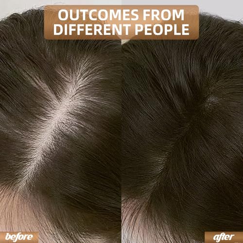 Red Light Therapy for Hair Growth, Laser Cap Hair Regrowth For Women and Men