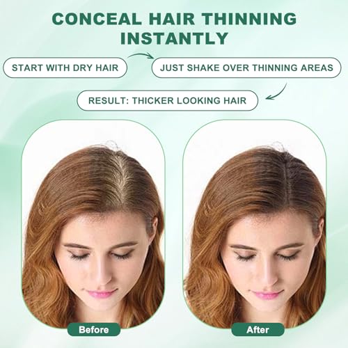 Hair Fibers, Hair Fibers for Thinning Hair, Hair Building Fibers, Hairpiece Filler, Increase Hair Density, Styling Powder for Women & Men, Hair Makeup, Premium Formula Thickening (DARK BROWN)