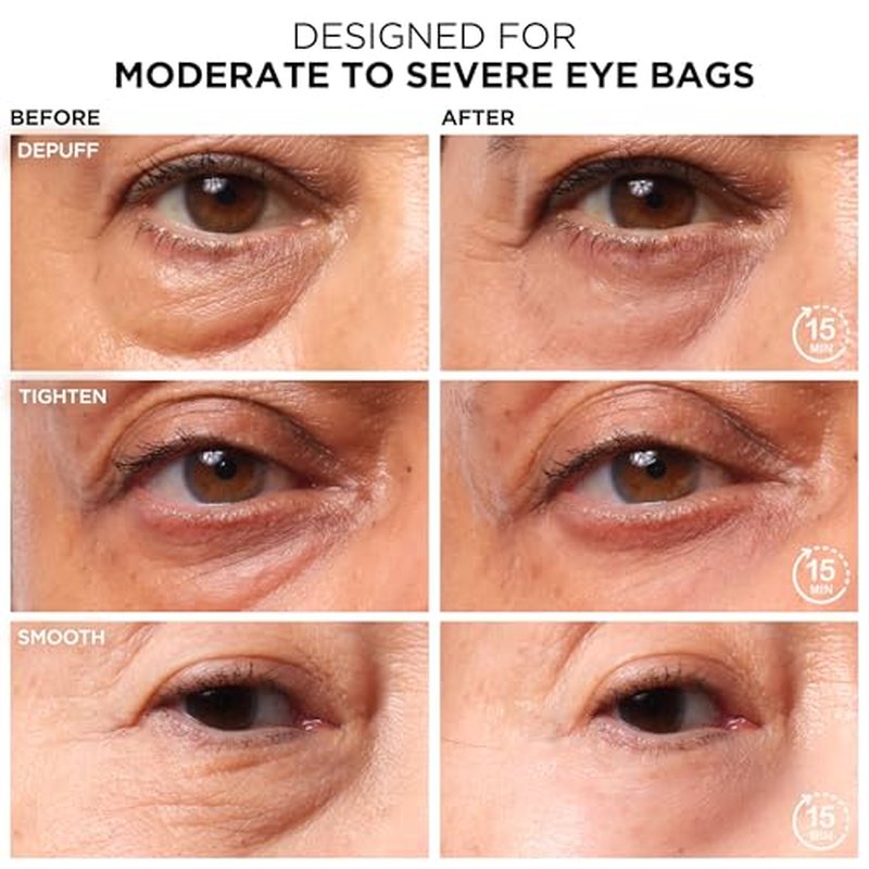 IT Cosmetics Bye Bye Under Eye Bags Treatment For Women & Men ? Temporary Eye Bag Reducer & Undereye Corrector Depuffs, Tightens, Smooths & Reduces Look of Wrinkles & Fine Lines - 0.5 Fl. Oz