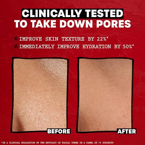 THAYERS Alcohol-Free Rose Petal Witch Hazel Facial Toner for Glowing Skin, Soothing, Hydrating, Refreshing Toner for All Skin Types, 12oz (Packaging May Vary)