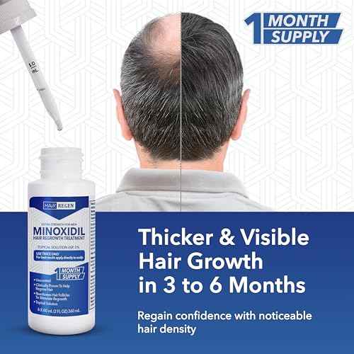 Hair-Regen Advanced 5% Minoxidil For Men Hair Regrowth Treatment for Thinning Hair - Hair Loss for Men - 6 Month Supply, Minoxidil Topical Solution So Thicker Fuller Hair Keeps Growing Amazing Results