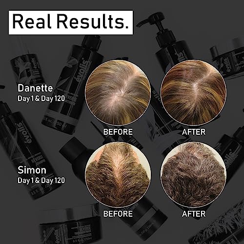 EVOLIS Prevent Anti-Aging Conditioner, Natural Anti Hair Loss Conditioner for Men and Women - Ideal for Sensitive, Dry Scalp and Oily Hair - Preventative Hair Loss Treatment (8.5 fl oz)