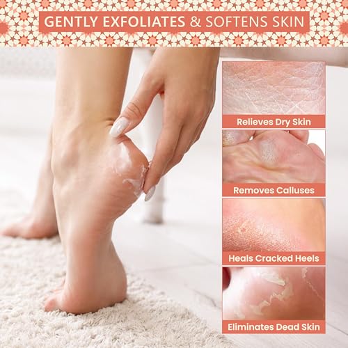 Natural Terracotta Pumice Stone for Feet ? Handcrafted Foot Scrubber & Callus Remover with Gentle Exfoliation and Ergonomic Design for Smooth, Soft & Refreshed Feet ? for a Spa-Like Pedicure