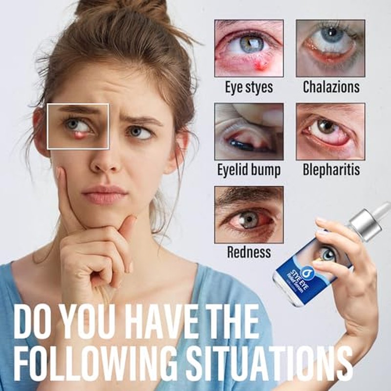 Stye Eye Treatment, Natural Stye Remover, Eye Stye Relief Serum, Premium Formula - Gentle Cleanser for Chalazion & Blepharitis (1 Fl Oz (Pack of 1))