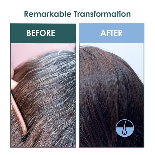 SH-RD Intensive Scalp Essence for Anti-Aging | Promotes Hair Growth with Amino Acids, Protein, Vitamin B5 | Lightweight Serum - 50ml/1.69oz