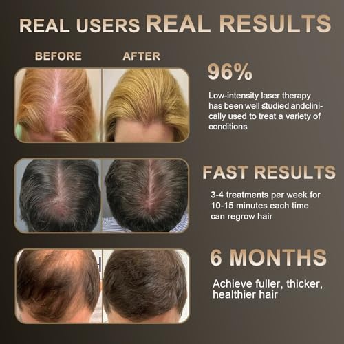 Laser Hair Growth Comb, Hair Growth Device, promote hair growth in women and men