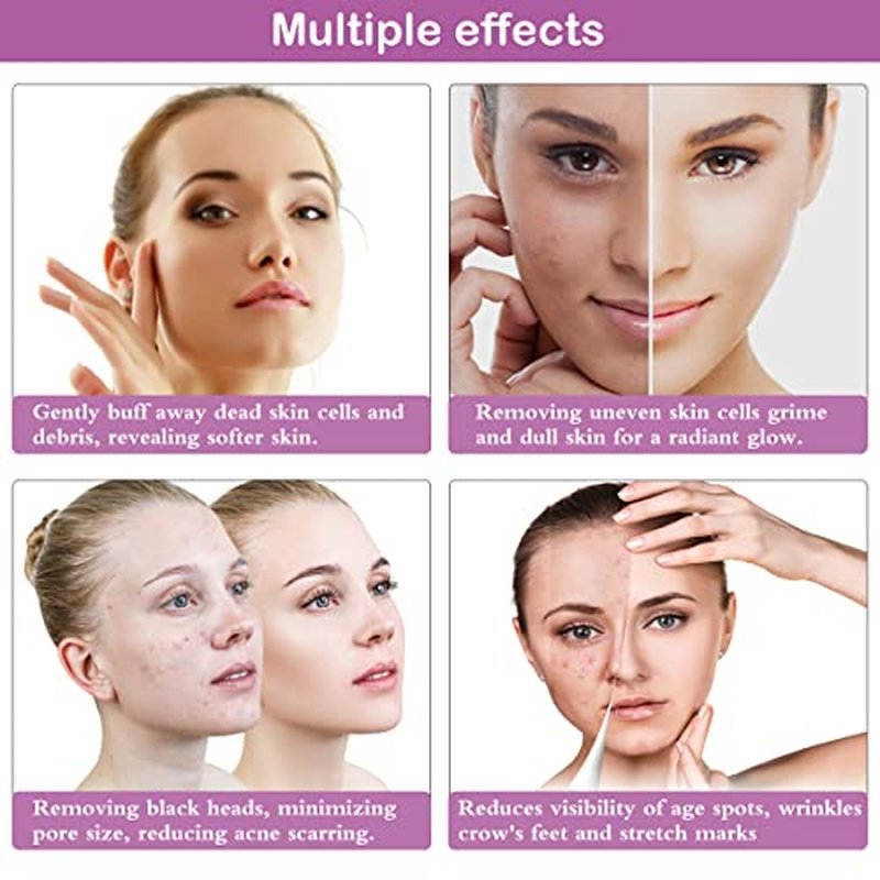 Diamond Microdermabrasion Machine, Yofuly 65-68cmHg Suction Power Professional Dermabrasion, Home Use Facial Skin Care Equipment