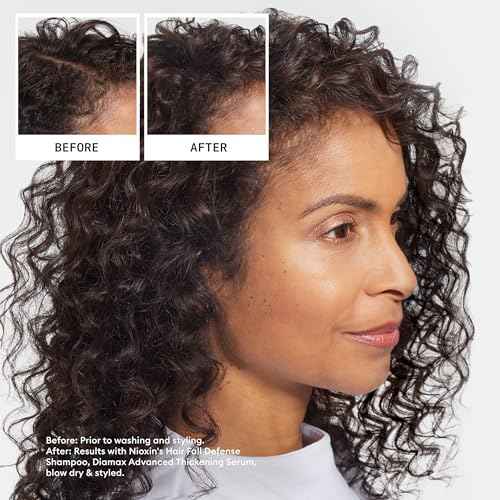 Nioxin Hair Fall Defense Shampoo | Activates Hair Follicles for Visibly Less Hair Loss| With Lauric Acid, Caffeine, Niacinamide and Sandalore