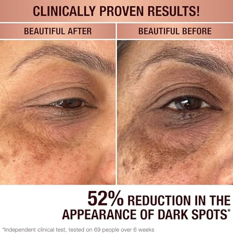 Charlotte Tilbury Radiance Recovery Dark Spot Serum - Dark Spot Corrector & Vitamin C Serum for a Brighter-Looking Complexion - Helps Reduce the Appearance of Redness & Uneven Skin Tone