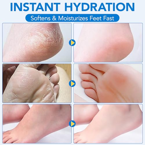 Urea Cream 60% plus Salicylic Acid 2% Urea Foot Care Stick, Foot Cream for Foot Callus Remover, Feet Moisturizer Stick for Dry Cracked Heels, Hands, Knees, Hydrating Heel Balm, Easy To Use