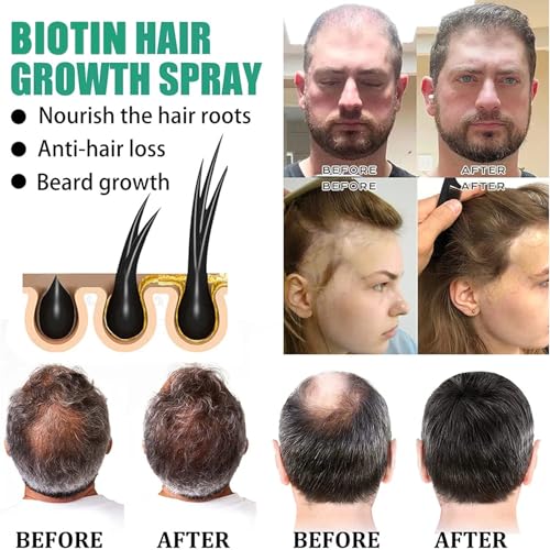 Biotin Hair Growth Serum£¬Hair Growth Spray Containing Ginseng Root Extract and Ginger Root Extract£¬Moisturizes the scalp, strengthens hair follicles, prevents hair loss, and promotes hair growth.