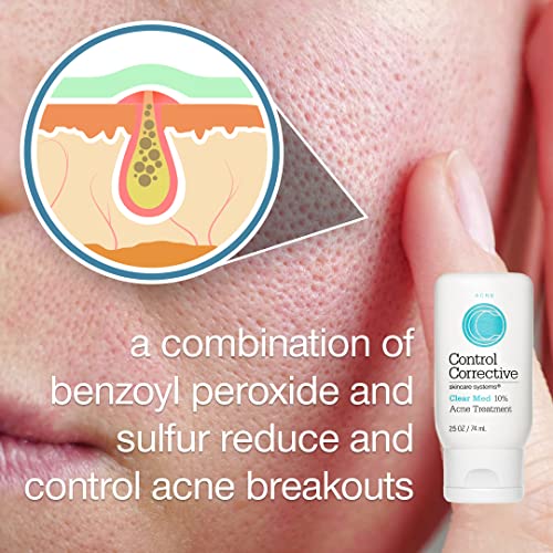 CONTROL CORRECTIVE Clear Med 10% Acne Treatment Lotion, 2.5 Oz - Helps Clear & Control Breakouts, Benzoyl Peroxide, 3% Sulfur To Improve Efficacy And Dry Up Blemishes