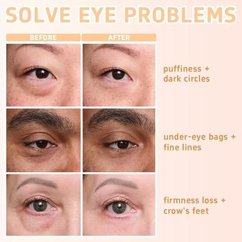 Perfection Eye Tightener - Instant Firming Primer with Hyaluronic Acid & Vitamin E | Hydrating Lift for Tired Eyes, Smooth Finish & 24H Refresh With Brush (0.67oz)
