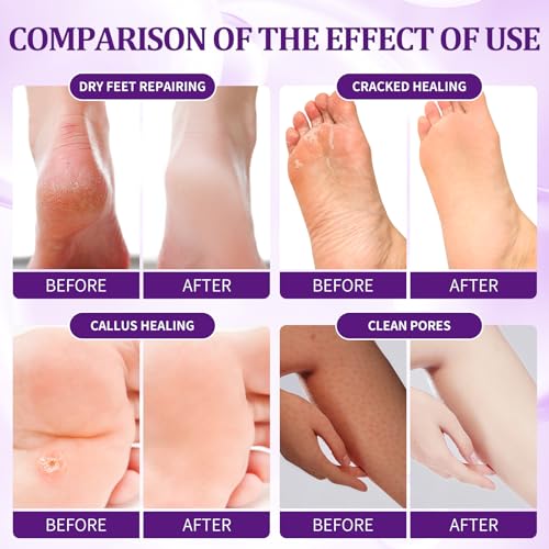 Pedicure Kit Foot Soak Set: Bubble Salt, Sugar Scrub, Massage Mask, Massage Lotion in a Box, 4 Step Foot Spa Kit for Dry Feet,Tired Feet£¨1 Set Lavender)