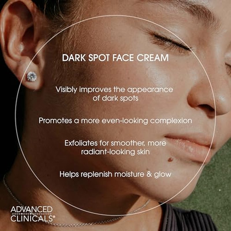Advanced Clinicals Dark Spot Face Moisturizer | Lactic Acid Lotion For Face With Caffeine, Cocoa Butter, & Vitamin A | Brightening Cream Visibly Reduces Look Of Dark Spots & Uneven Skin Tone, 2 Fl Oz