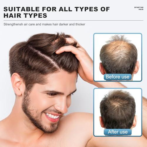 Root Activator Shampoo for Men -Strengthening & Smoothing Restoring System for Gray Hair, Thinning Hair - Men & Women 5.07 fl oz / 150 mL