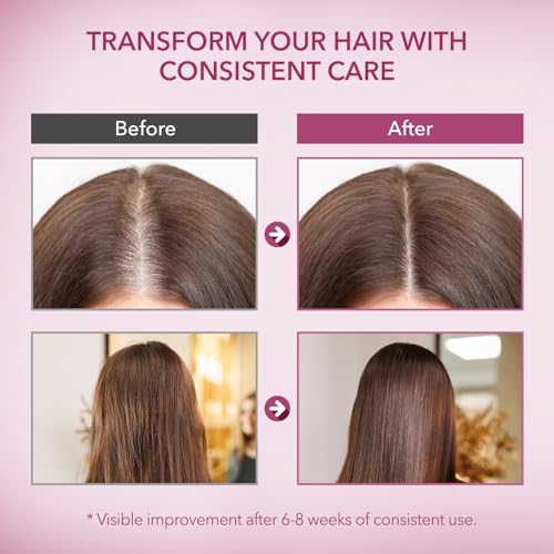 Onion & Rosemary Hair Growth Shampoo: Biotin Infused Shampoo for Hair Loss and Thinning Hair - Promotes Healthier, Thicker and Stronger Hair for Women and Men (16.9 Fl Oz (Pack of 1))