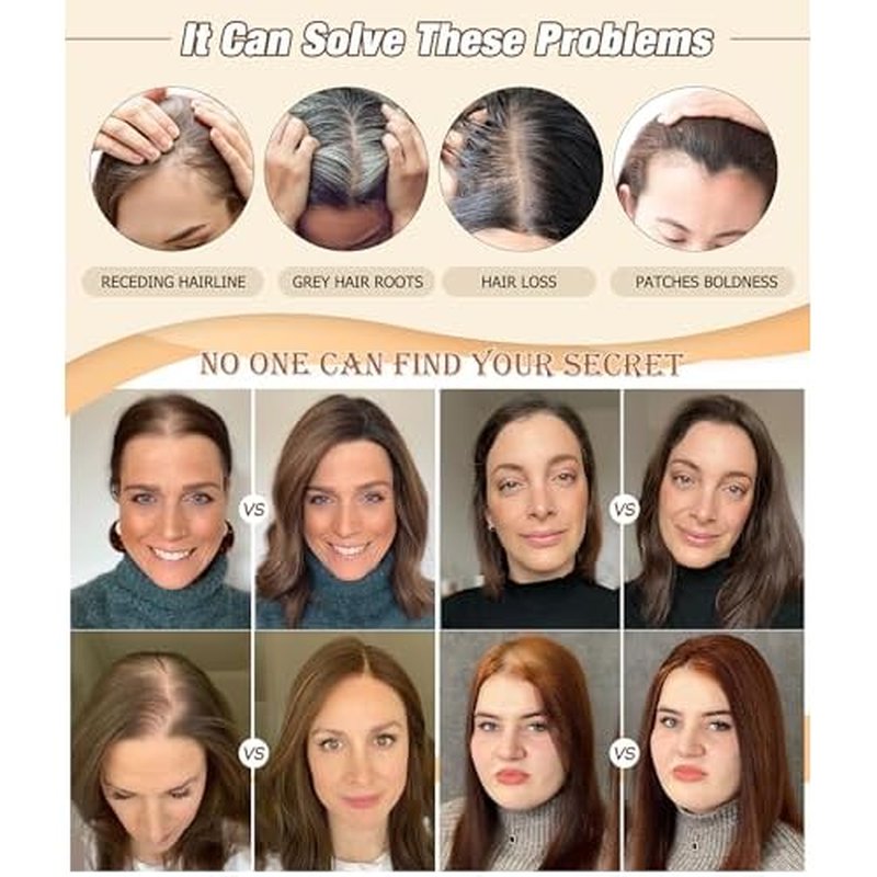 Large Coverage 5.1x5.9inch Hair Toppers for Women Real Human Hair No Bangs Swiss Base Wig Topper Womens Hair Topper for Thinning Hair 150% Density Remy Hair Wiglets #2